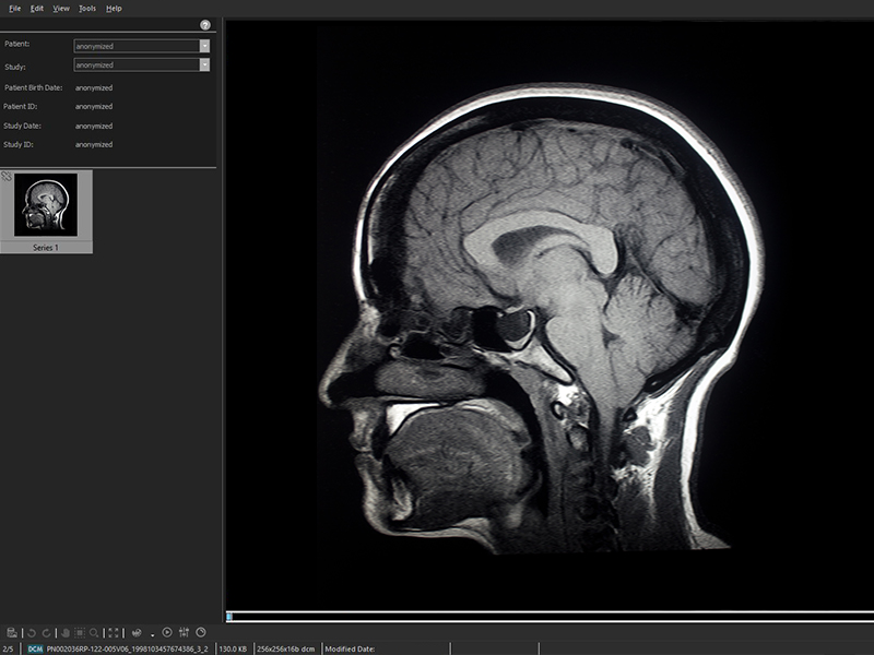 SeePlus DICOM Screenshot SeePlus DICOM Screenshot